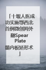 十堰人医成功实施鄂西北首例微创拇外翻Spear Plate髓内板矫形术