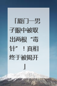 厦门一男子眼中被取出两根“毒针”！真相终于被揭开