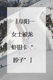 阜阳一女士被龙虾钳卡“脖子”